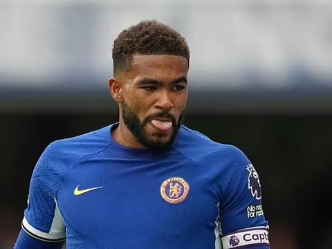 James chấn thương, Pochettino phá vỡ im lặng