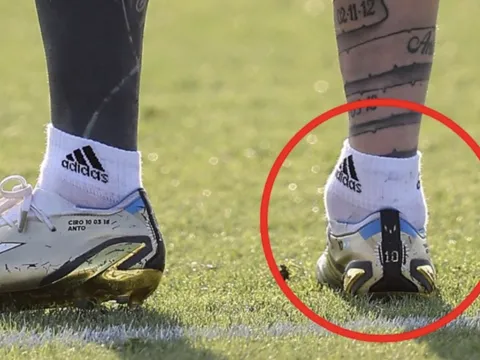 Mắt cá chân bất thường của Messi