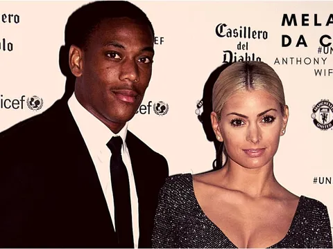 Martial vắng mặt vì chấn thương? Vợ sao Pháp có câu trả lời