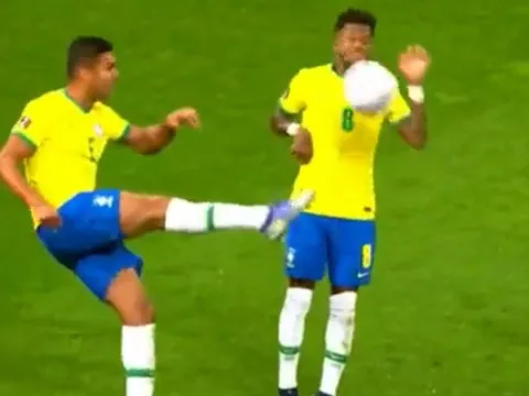 Fred bị đồng đội đá bóng thẳng vào mặt