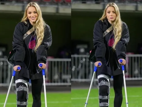 Người đẹp tuyển Croatia chống nạng vẫn thu hút ánh nhìn