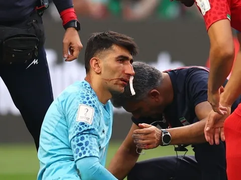 Rủi ro khi cho thủ môn Iran vào sân sau va chạm mạnh ở đầu