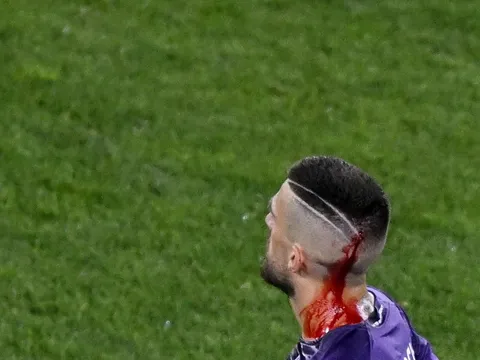 Sao Fiorentina bị CĐV ném chảy máu đầu ở chung kết Conference League