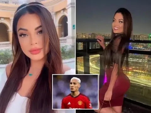 Tung bằng chứng cho thấy sự đồng thuận, Antony bị nạn nhân chỉ trích