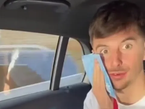 Hình ảnh hài hước của Mason Mount sau khi nhổ răng khôn