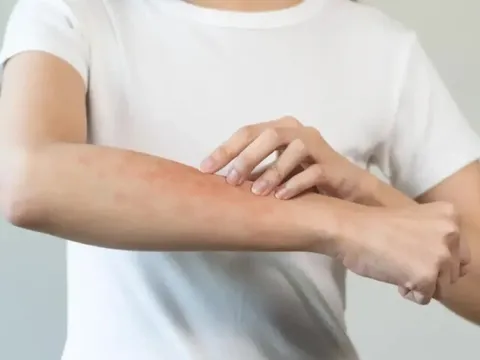 Trời nắng nóng kèm mưa ẩm, đây là tác nhân gây hại sức khỏe cả nhà nhưng rất khó tiêu diệt