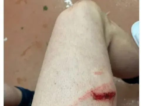 Sao Man City dính chấn thương rùng rợn sau trận hòa với Southampton