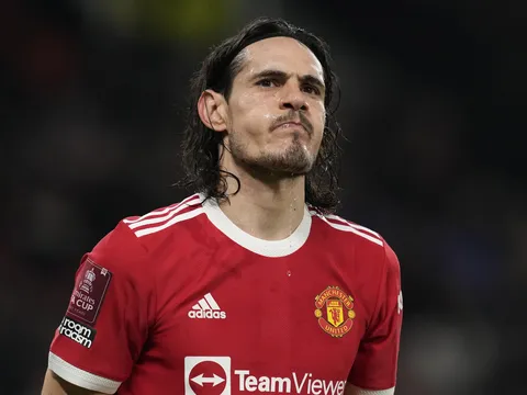 3 lý do Cavani nên được đá chính ở trận gặp Bunrley