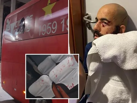 Cầu thủ Bahia thoát chết thần kỳ trong một vụ đánh bom xe buýt