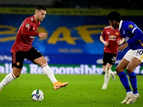CĐV Man United: "Xem cậu ta chơi bóng thật chướng mắt"