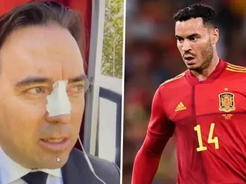 Đàm phán bất thành, chủ tịch bị người đại diện húc đầu gãy mũi