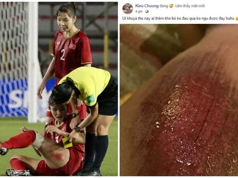 SỐC! Lộ hình ảnh đau đớn chẳng kém "đầu gối đẫm máu" của Trọng Hoàng