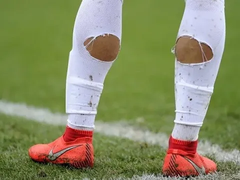 Tại sao các cầu thủ lại khoét lỗ trên tất?