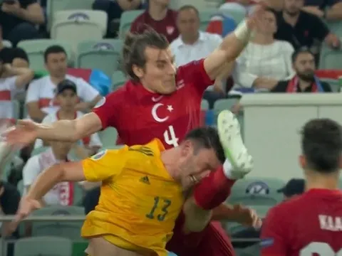 Sao xứ Wales đổ máu sau cú vung chân thẳng vào mặt