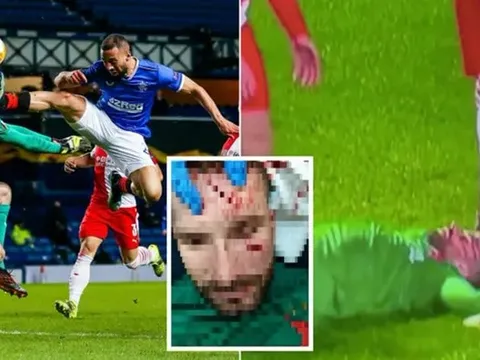 SỐC! 'Tung cước' kinh hoàng, học trò của Gerrard khiến đối thủ đổ máu