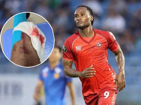 SỐC! Va chạm với đồng đội, ngoại binh Hải Phòng chấn thương nặng