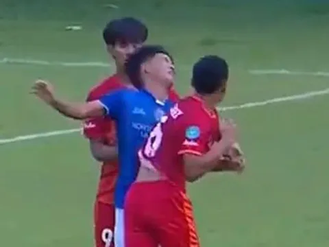 Cầu thủ Thái Lan đánh chỏ khiến đối thủ khâu 24 mũi