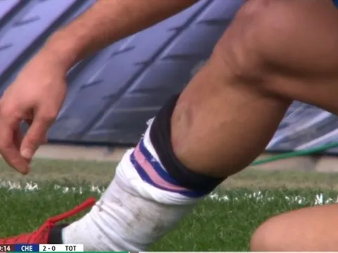 CHOÁNG! Lộ hình ảnh kinh hoàng cú đạp chân của Lo Celso với Azpilicueta