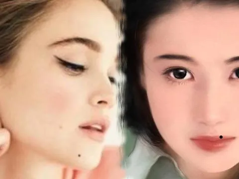 4 nốt ruồi may mắn: Ai có được phúc đức cả đời