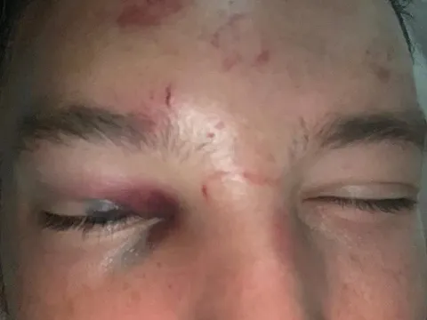 Chelsea ra phán quyết cho trò chơi ngông của "bom xịt"