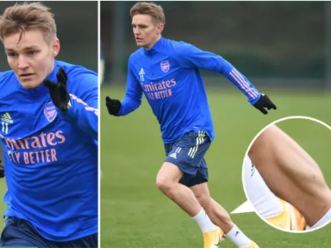Chỉ với 1 bức ảnh, Odegaard chứng tỏ không hề kém cạnh Grealish