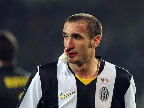 Giorgio Chiellini: Khi máu và mồ hôi tạo nên người đội trưởng vĩ đại