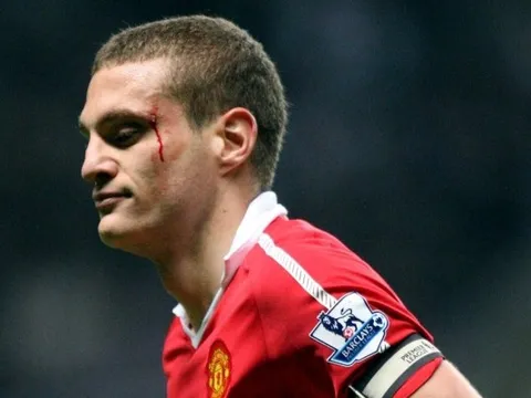 Không phải Torres, Vidic chỉ ra tiền đạo Liverpool gây choáng ngợp