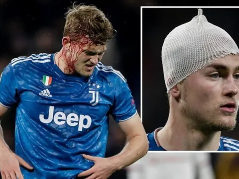 “Sự vắng mặt của De Ligt đã giúp Lyon đánh bại Juventus”