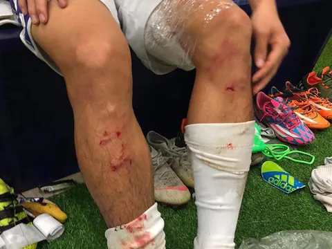 Suýt “phang” gãy chân đồng nghiệp, HLV Viettel vẫn khen ngợi Quế Ngọc Hải