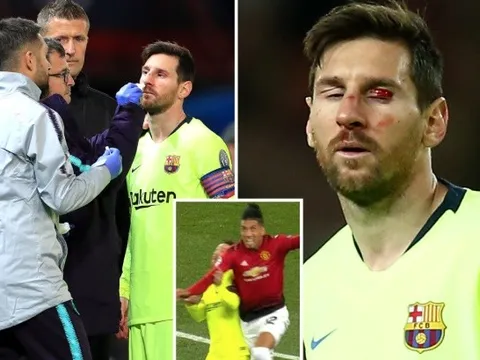 SỐC: Vẻ ngoài 'không thể tin được' của Messi sau cú tát của Smalling