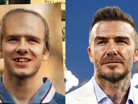 Beckham từng bị dự đoán hói đầu, rụng răng vào năm 2020