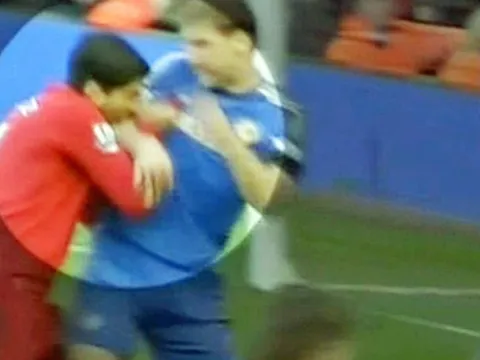 Góc hoài niệm: "Hàm răng vàng" của Suarez