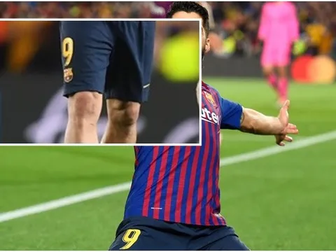 Liverpool! Xin hãy quên một gã dứt điểm bằng đầu gối