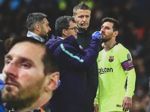 Smalling có thể không biết, nhưng vô tình khám phá ra "điểm yếu" của Messi