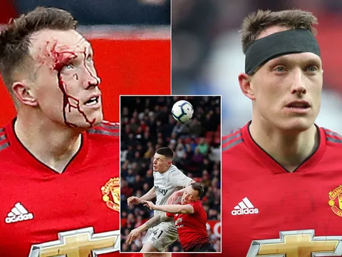Phil Jones 'đổ máu' là tấm gương cho các cầu thủ Man Utd thời điểm này