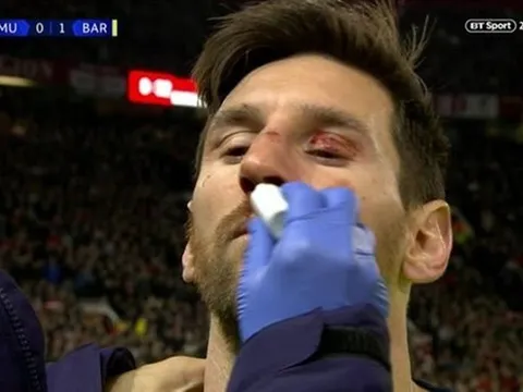 Smalling khiến Messi đổ máu ở Old Trafford