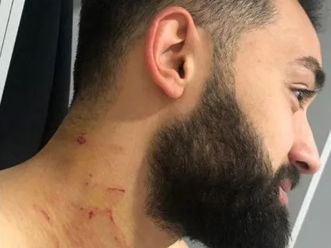 Sốc: Cầu thủ bị đối thủ dùng dao cứa cổ ngay trên sân