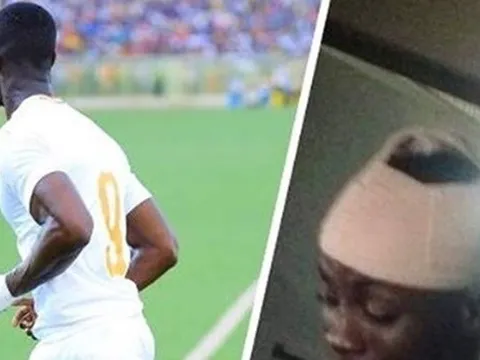 SỐC NẶNG! Hậu vệ M.U mặc áo số 9, ghi bàn rồi chấn thương đầu rời sân