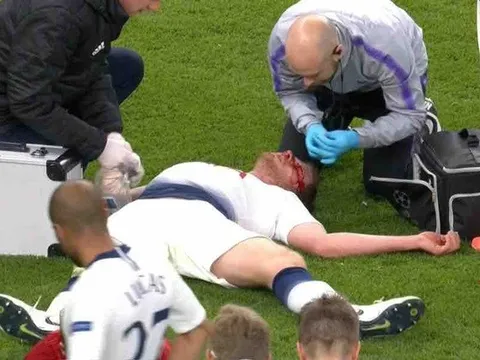 Tình trạng Vertonghen ra sao sau chấn thương kinh hoàng trước Ajax?