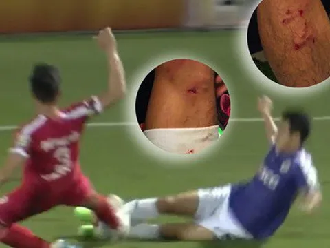 Quế Ngọc Hải và 4 dấu đinh trên ống đồng Văn Kiên: Bao giờ mới thôi?