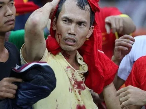 AFF Cup và top 6 'trò bẩn' khiến Đông Nam Á muối mặt