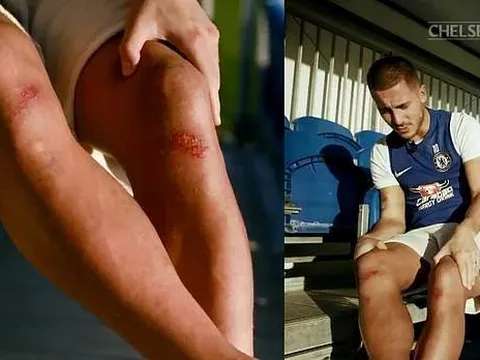 Chỉ đôi chân đỏ tấy, Hazard hứa bỏ thói quen ăn mừng