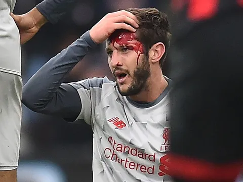 Hình ảnh rợn người của Lallana trước Bournemouth