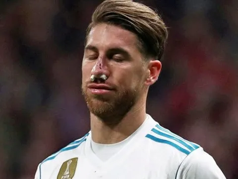 Cập nhật tình hình chấn thương mũi của Sergio Ramos