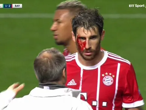 Javi Martinez đổ máu giúp Bayern giật 3 điểm rời Scotland