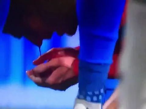 "Ngựa quen đường cũ", Ramos đánh vỡ mũi cầu thủ Plzen