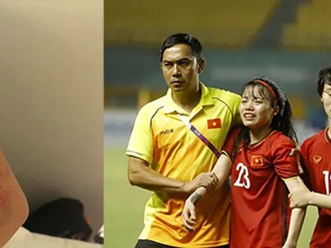 Bị ném đá vì tô son khi ra sân, nữ tuyển thủ Việt Nam viết tâm thư nghẹn ngào