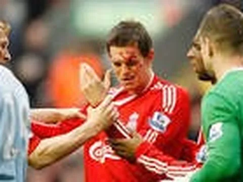 Vì sao Liverpool đang rất nhớ những mẫu trung vệ như Daniel Agger