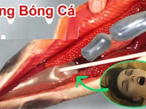 2 bộ phận quý nhất của con cá, nhiều người không biết bỏ phí