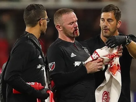 Rooney ghi bàn đẳng cấp rồi đổ máu trong chiến thắng của DC United
